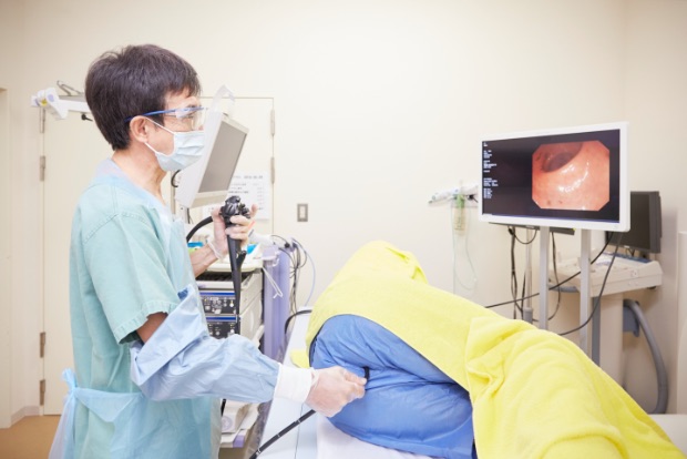 大腸内視鏡検査